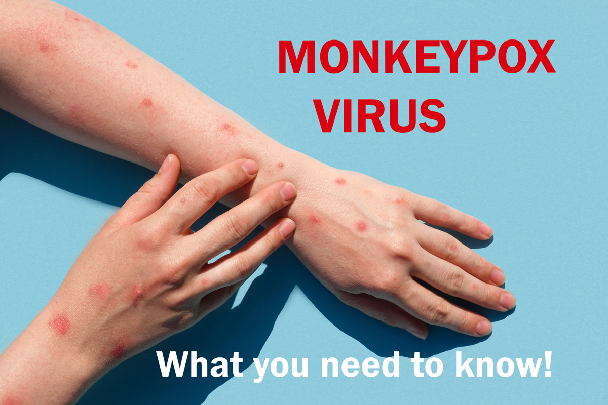 Monkeypox-Everything You Need to Know