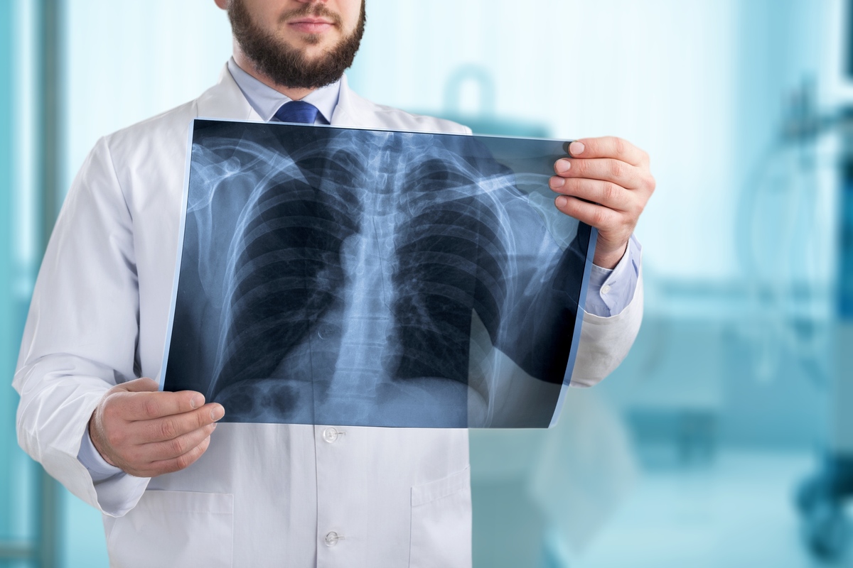 Lung Cancer: Types, Symptoms, & Treatment