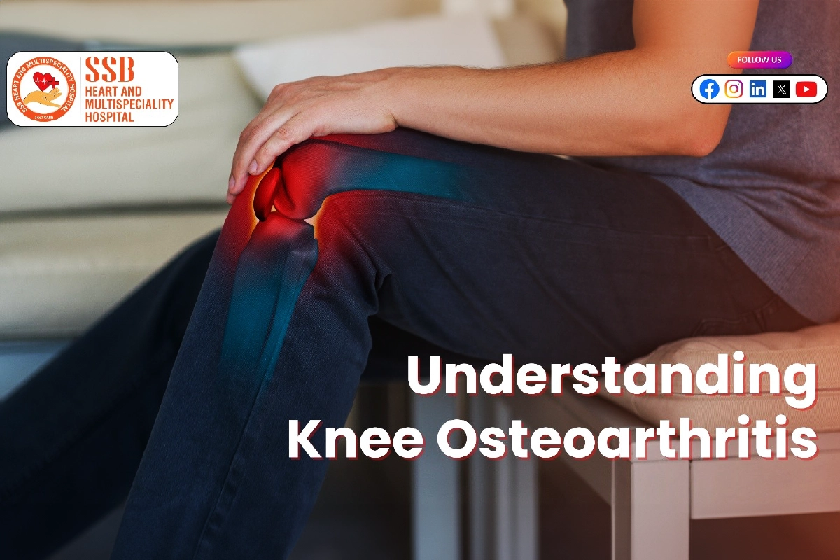 Understanding Knee Osteoarthritis: Causes, Symptoms, and Treatment Options