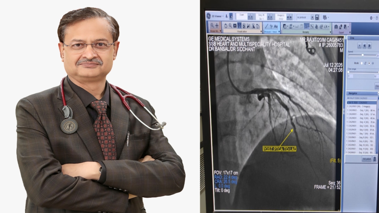 20 वर्षीय युवक को आया हार्ट अटैक, एसएसबी अस्पताल ने इलाज कर बचाई जान