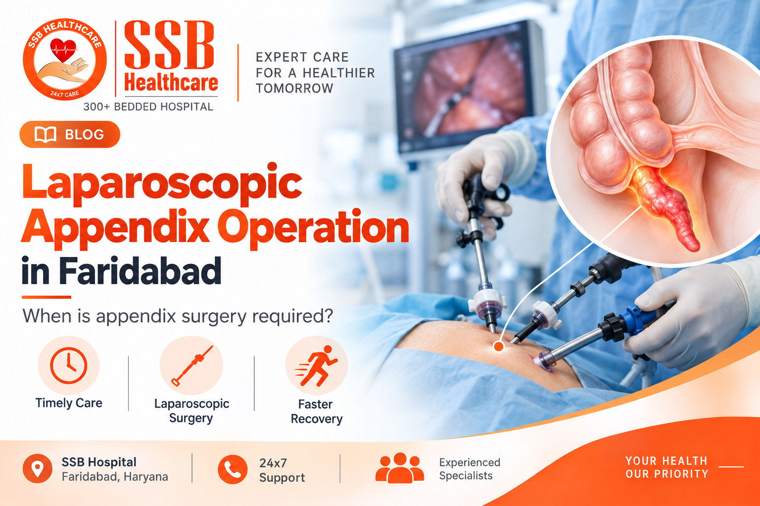 Appendix Operation in Faridabad: Symptoms That May Require Emergency Surgery